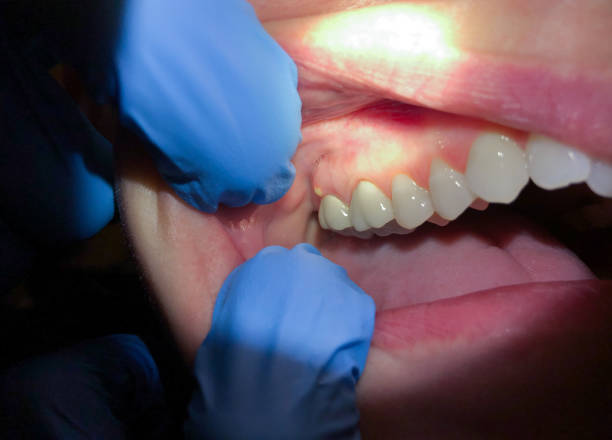 Best Orthodontic Emergency Dentist in Camilla, GA