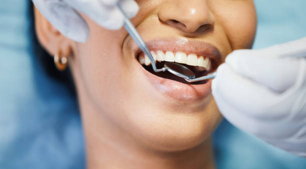 Best Emergency Root Canal Treatment in Camilla, GA
